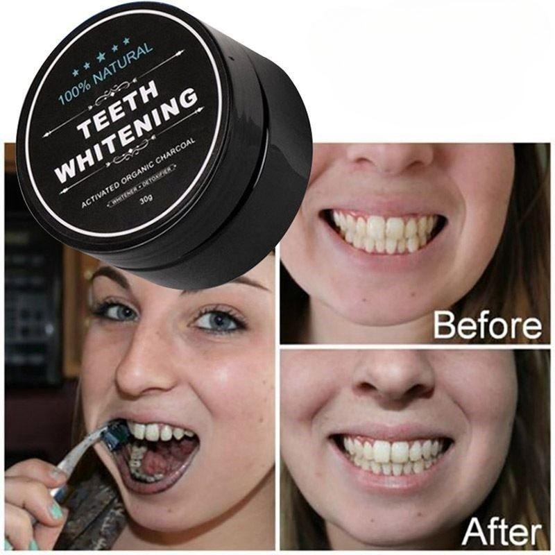 1 Box Activated Charcoal Teeth - Teeth Whitening Pens recension och pris