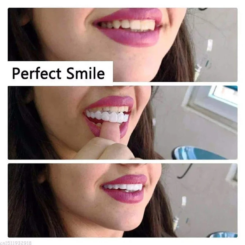 Snap-on Veneer Teeth Kit Adjus - Teeth Whitening Kit recension och pris